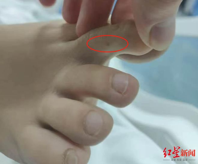 官方介入调查“27岁女子三亚旅游疑被不明物咬伤身亡”事件家属：未来有考虑尸检(图1)